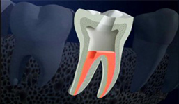 Phẫu thuật chỉnh răng