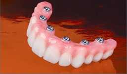 Thân răng và thiết bị nối